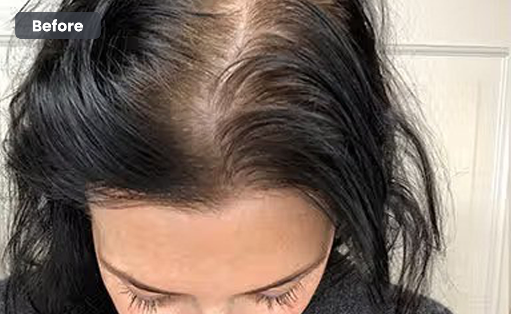 After
